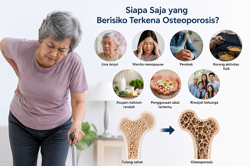 resiko osteoporosis